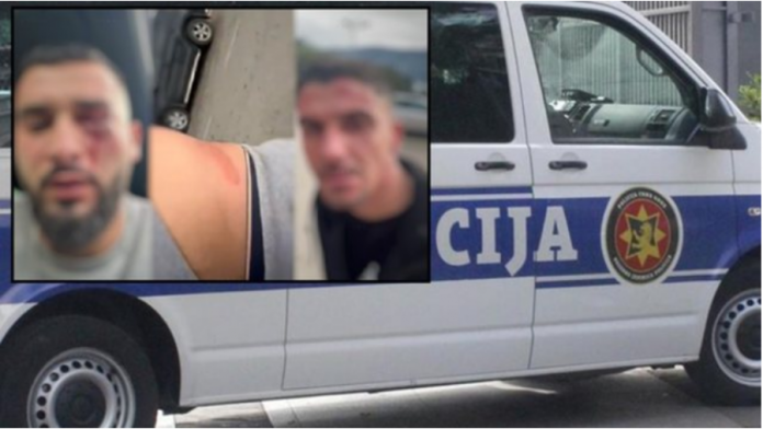 auto_dhuna-mal-zi-shqiptaret1704651486