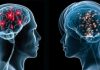 Shpresë për pacientët me Parkinson, terapia e re staminale tregoi përmirësime të shpejta të simptomave