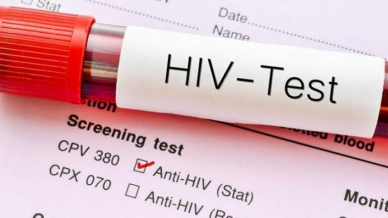 Raporti i HIV 2025  Shqipëria përballë një vale të re infeksionesh  rekord që nga 2016 a