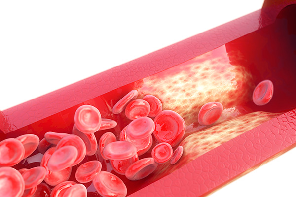 Hipertensioni  shkaqet  diagnostikimi dhe trajtimi i tij