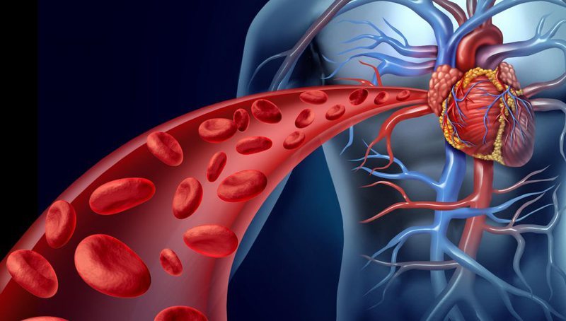 Arterioskleroza  sëmundja tinëzare  4 kura natyrale që iu vijnë në ndihmë