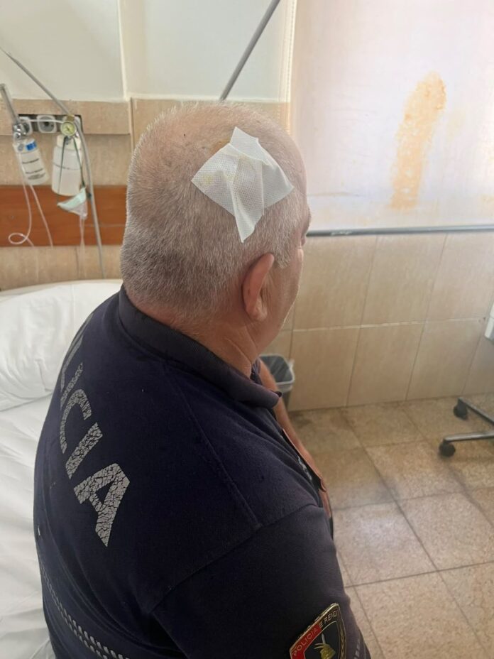 Plagosen pesë efektiv të policisë gjatë protestës së sotme para Parlamentit