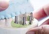 Shumllojshmëri implantesh dentare në treg por a e din pacientët realisht se çfarë implanti i është vendosur në gojë?