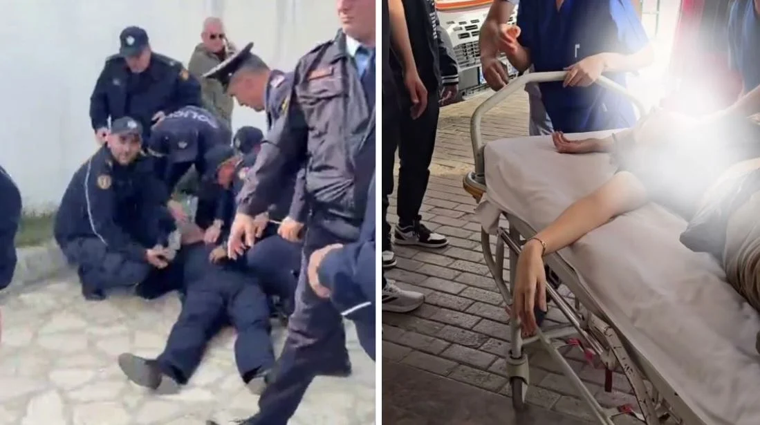 Mbetën të plagosur rëndë gjatë protestës  si paraqitet gjendja e shefit të rendit të Shkodrës dhe 34 vjeçares protestuese  në monitorim intensiv te Trauma